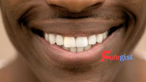 picture of Teeth Whitening 